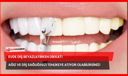 Evde Diş Beyazlatırken Dikkat! Ağız Ve Diş Sağlığınızı Tehlikeye Atıyor Olabilirsiniz!