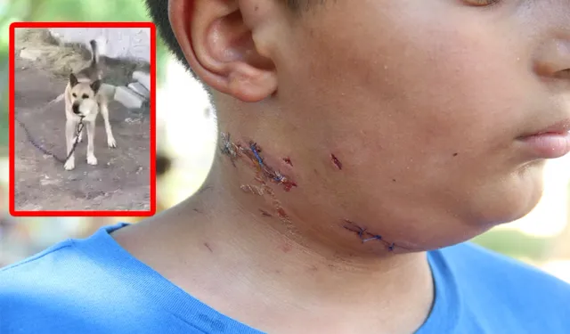 Köpek saldırısına uğrayan 10 yaşındaki çocuk ölümden döndü