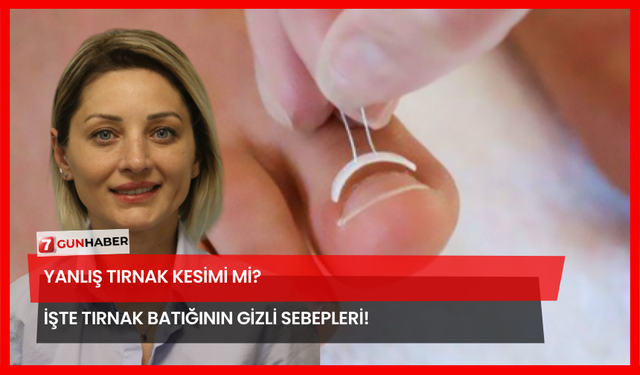 Yanlış Tırnak Kesimi Mi? İşte Tırnak Batığının Gizli Sebepleri!