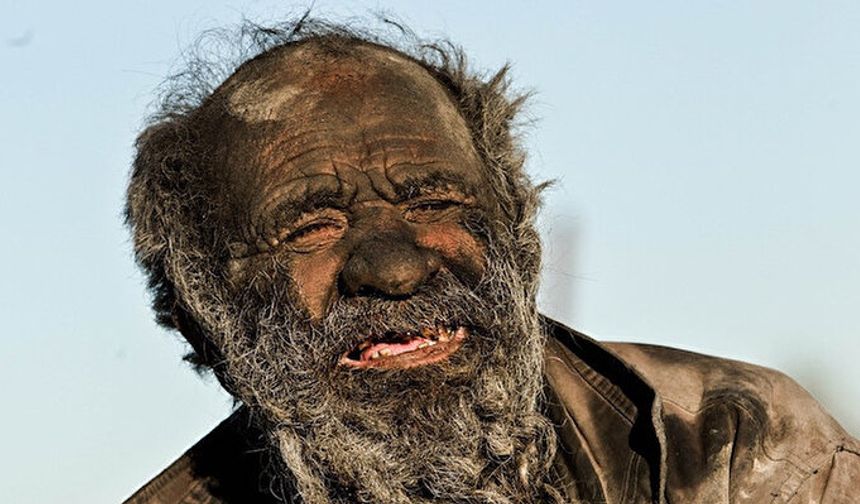 Dünyanın En Kirli Adamı 94 Yaşında Öldü! Ölüm Sebebi İse Çok Şaşırtıcı