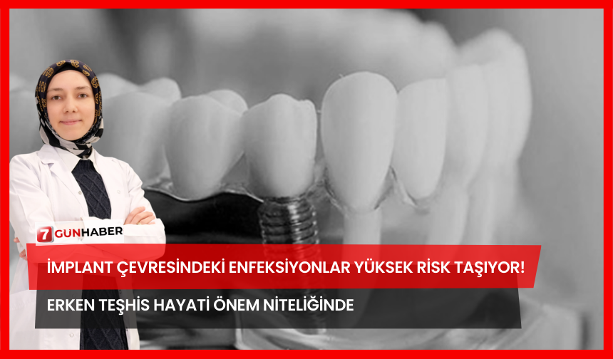 İmplant Çevresindeki Enfeksiyonlar Yüksek Risk Taşıyor! Erken Teşhis Hayati Önem Niteliğinde